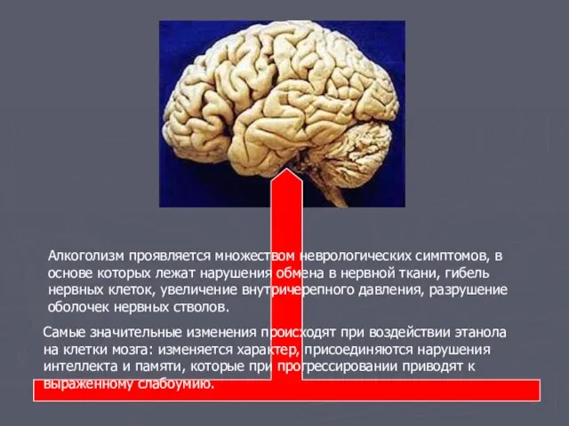 Алкоголизм проявляется множеством неврологических симптомов, в основе которых лежат нарушения обмена в