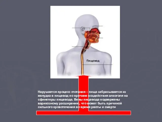Пищевод Нарушается процесс глотания – пища забрасывается из желудка в пищевод по