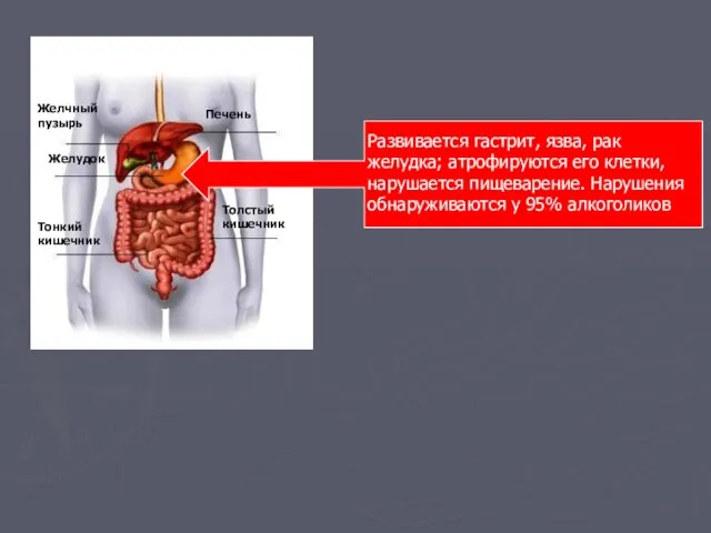 Печень Желчный пузырь Желудок Тонкий кишечник Толстый кишечник Развивается гастрит, язва, рак