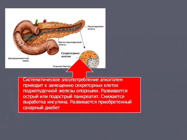 Секреторные клетки Систематическое злоупотребление алкоголем приводит к замещению секреторных клеток поджелудочной железы