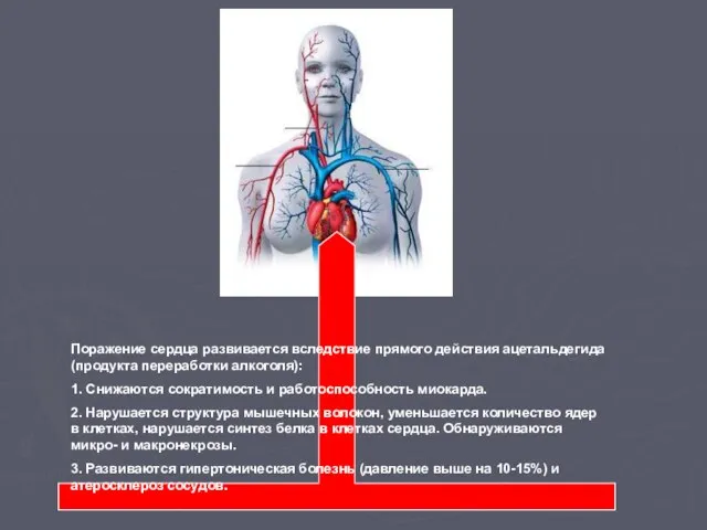 Поражение сердца развивается вследствие прямого действия ацетальдегида (продукта переработки алкоголя): 1. Снижаются