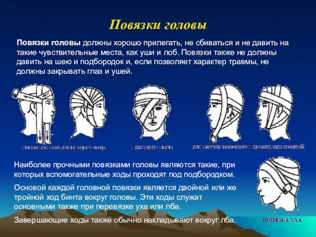 Повязки головы Повязки головы должны хорошо прилегать, не сбиваться и не давить