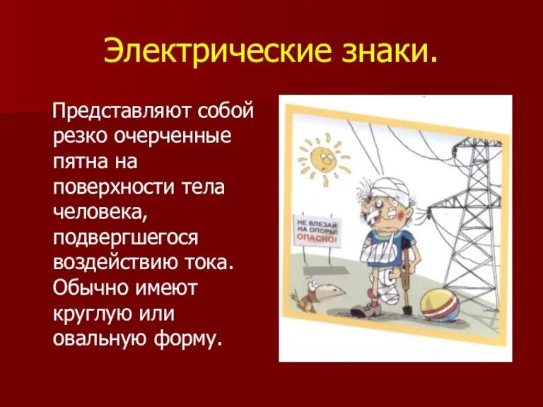 Электрические знаки. Представляют собой резко очерченные пятна на поверхности тела человека, подвергшегося