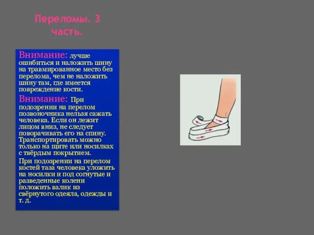 Переломы. 3 часть. Внимание: лучше ошибиться и наложить шину на травмированное место