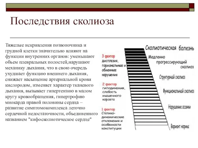 Последствия сколиоза Тяжелые искривления позвоночника и грудной клетки значительно влияют на функции