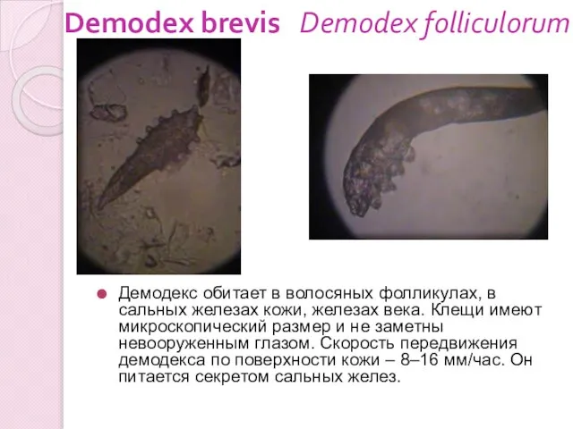 Demodex brevis Demodex folliculorum Демодекс обитает в волосяных фолликулах, в сальных железах
