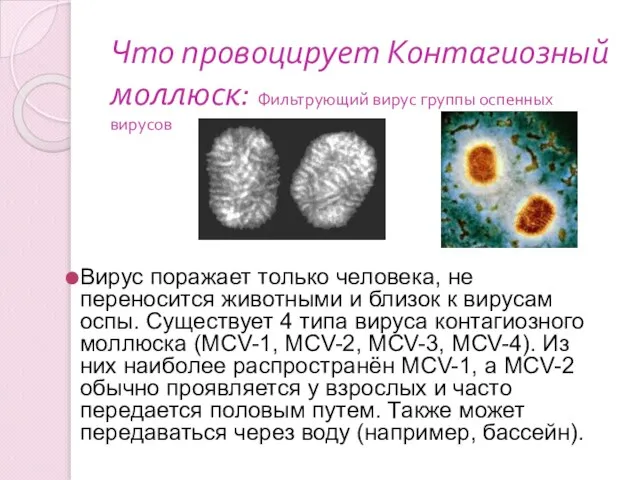 Что провоцирует Контагиозный моллюск: Фильтрующий вирус группы оспенных вирусов Вирус поражает только