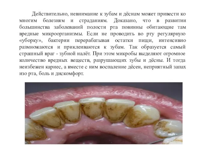 Действительно, невнимание к зубам и дёснам может привести ко многим болезням и