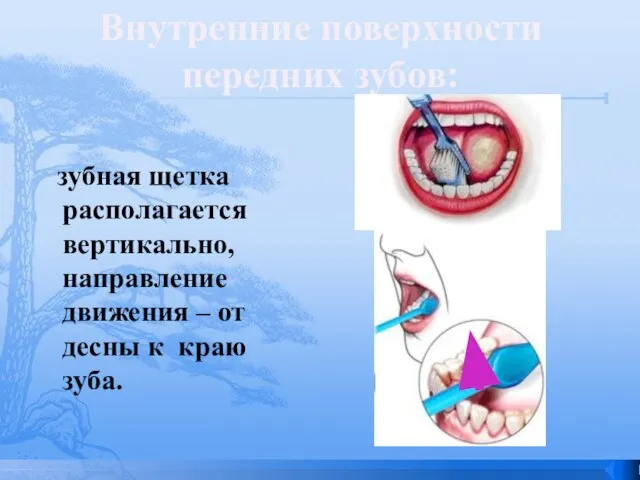 зубная щетка располагается вертикально, направление движения – от десны к краю зуба. Внутренние поверхности передних зубов: