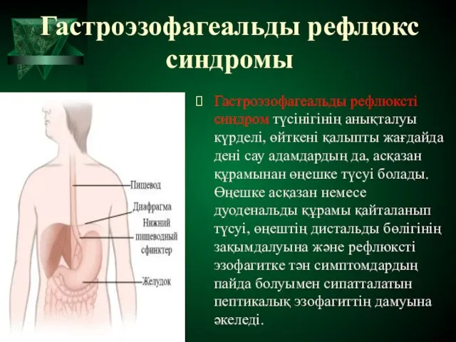 Гастроэзофагеальды рефлюкс синдромы Гастроэзофагеальды рефлюксті синдром түсінігінің анықталуы күрделі, өйткені қалыпты жағдайда