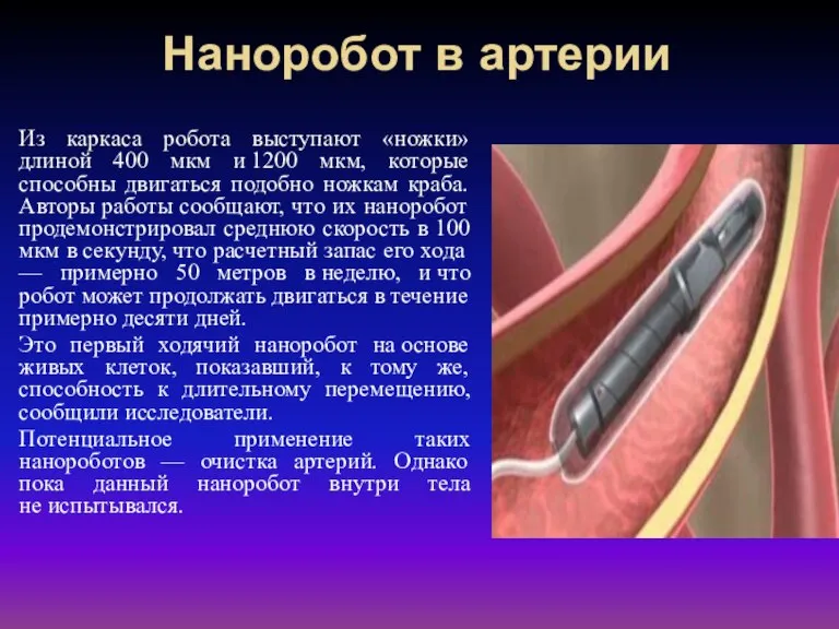 Наноробот в артерии Из каркаса робота выступают «ножки» длиной 400 мкм и