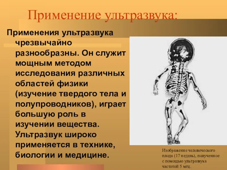 Применение ультразвука: Применения ультразвука чрезвычайно разнообразны. Он служит мощным методом исследования различных