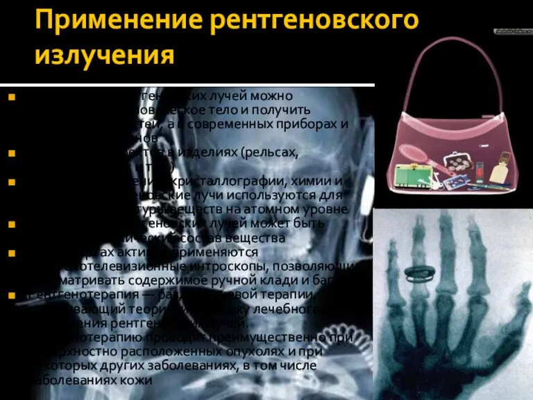 Применение рентгеновского излучения При помощи рентгеновских лучей можно «просветить» человеческое тело и
