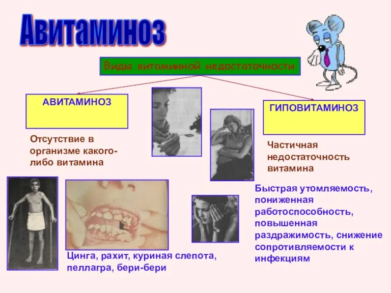 Авитаминоз Виды витаминной недостаточности АВИТАМИНОЗ ГИПОВИТАМИНОЗ Отсутствие в организме какого-либо витамина Цинга,