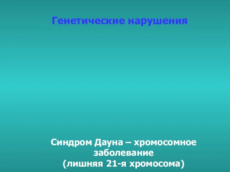 Синдром Дауна – хромосомное заболевание (лишняя 21-я хромосома) Генетические нарушения