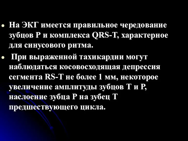 . На ЭКГ имеется правильное чередование зубцов Р и комплекса QRS-T, характерное