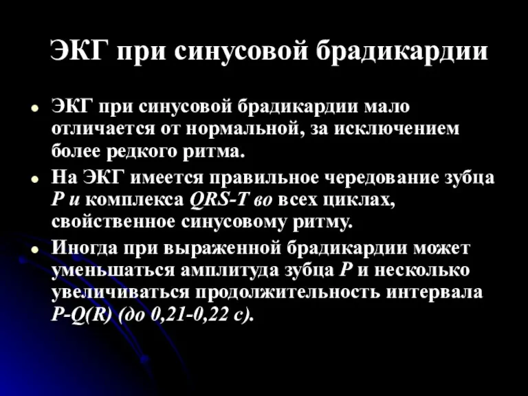 ЭКГ при синусовой брадикардии ЭКГ при синусовой брадикардии мало отличается от нормальной,