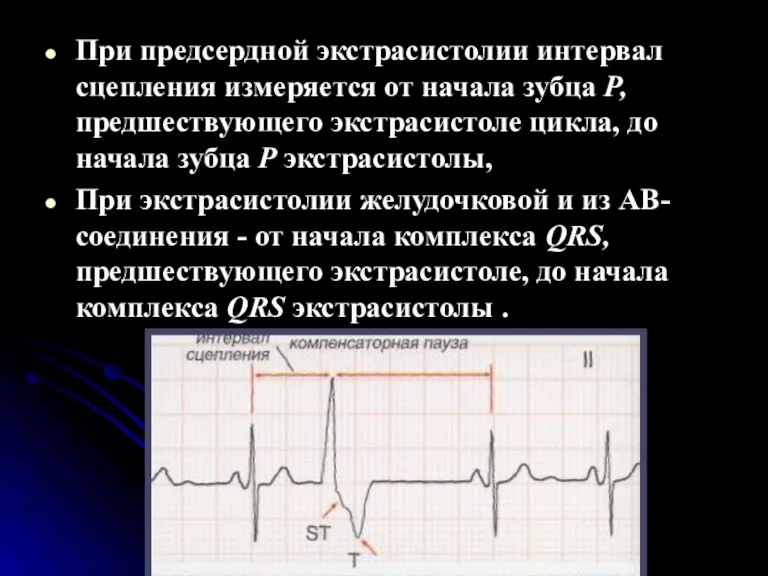 При предсердной экстрасистолии интервал сцепления измеряется от начала зубца Р, предшествующего экстрасистоле