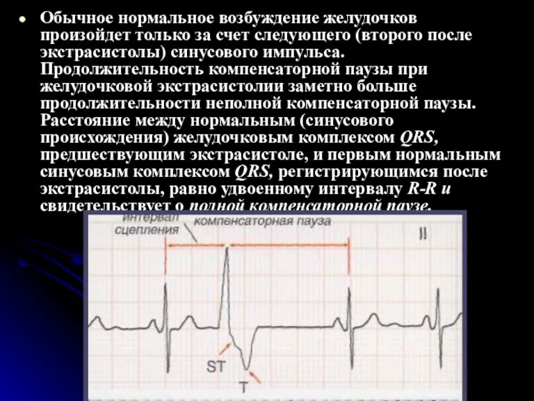 Обычное нормальное возбуждение желудочков произойдет только за счет следующего (второго после экстрасистолы)