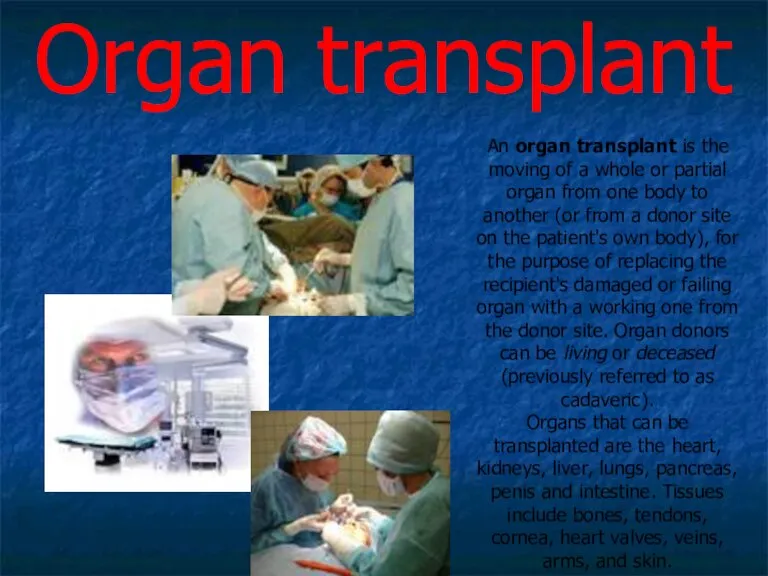 An organ transplant is the moving of a whole or partial organ
