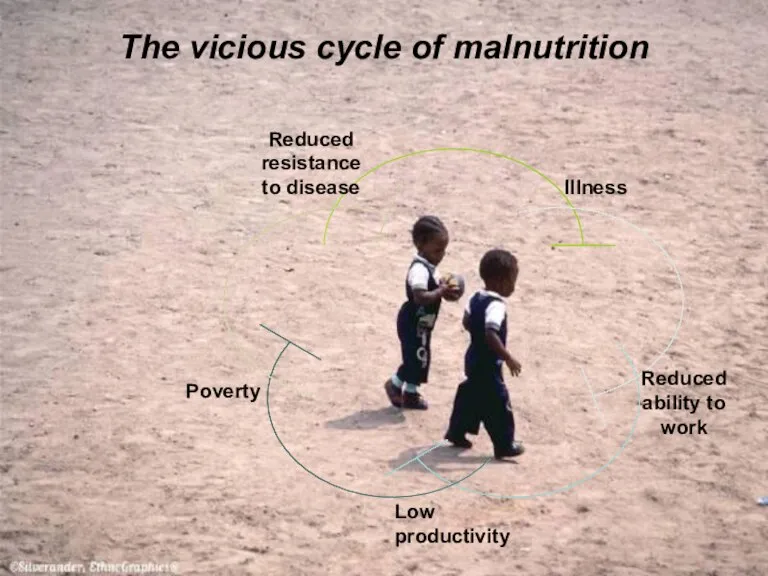 The vicious cycle of malnutrition