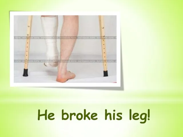 He broke his leg!