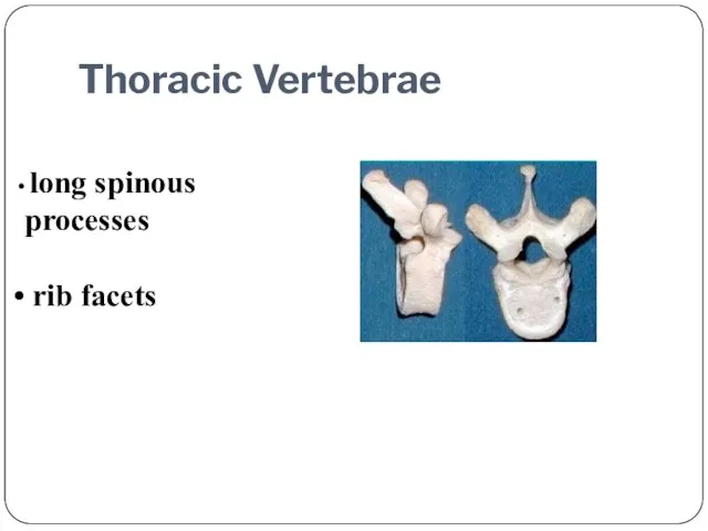 long spinous processes rib facets Thoracic Vertebrae