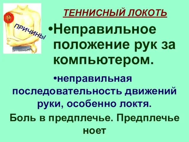 ТЕННИСНЫЙ ЛОКОТЬ Неправильное положение рук за компьютером. Боль в предплечье. Предплечье ноет