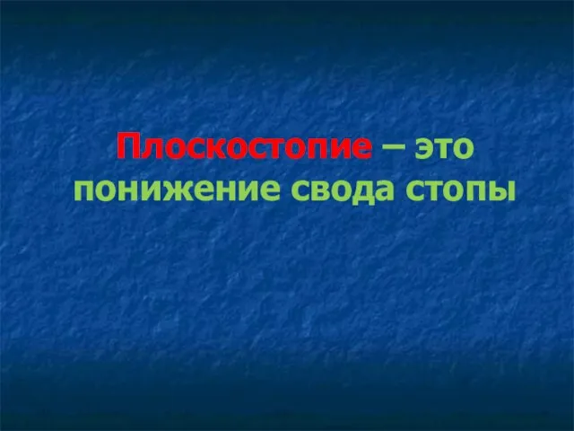 Плоскостопие – это понижение свода стопы