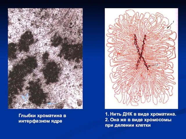 Глыбки хроматина в интерфазном ядре 1. Нить ДНК в виде хроматина. 2.