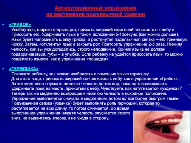 Артикуляционные упражнения на растяжение подъязычной уздечки «ГРИБОК» Улыбнуться, широко открыть рот, прижать