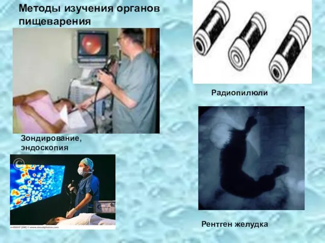 Методы изучения органов пищеварения Рентген желудка Зондирование, эндоскопия Радиопилюли