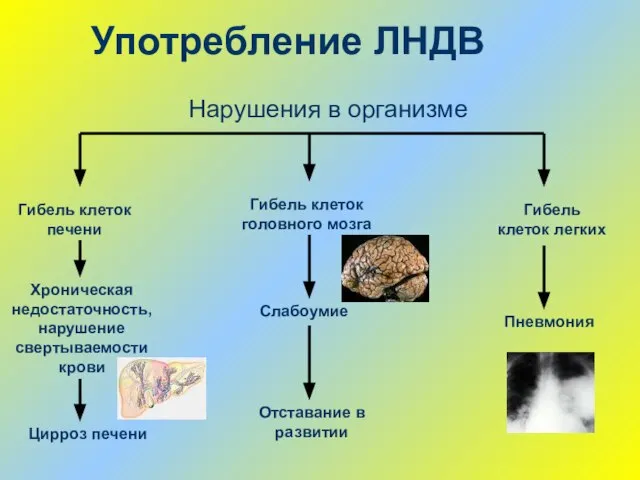 Употребление ЛНДВ Гибель клеток печени Хроническая недостаточность, нарушение свертываемости крови Цирроз печени