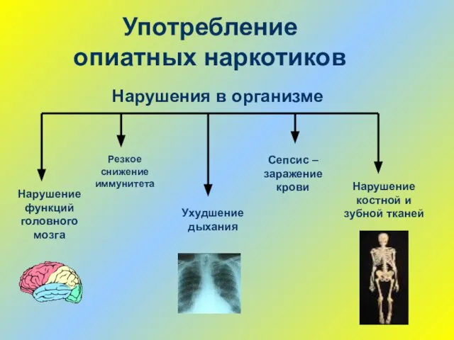 Употребление опиатных наркотиков Нарушение функций головного мозга Нарушение костной и зубной тканей