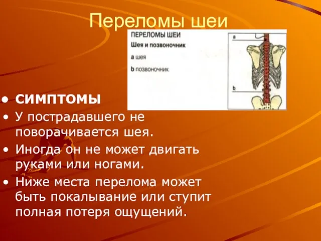 Переломы шеи СИМПТОМЫ У пострадавшего не поворачивается шея. Иногда он не может