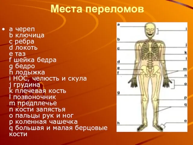 Места переломов а череп b ключица с ребра d локоть е таз