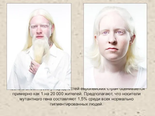 Частота альбиносов у народностей европейских стран оценивается примерно как 1 на 20