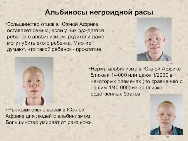 • Рак кожи очень высок в Южной Африке для людей с альбинизмом.