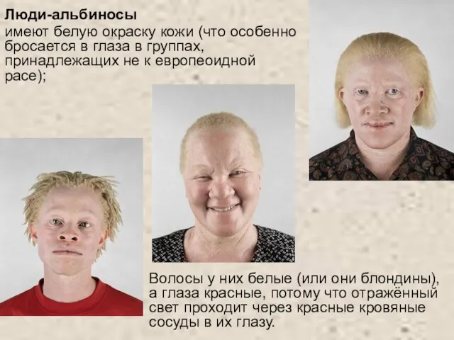 Люди-альбиносы имеют белую окраску кожи (что особенно бросается в глаза в группах,