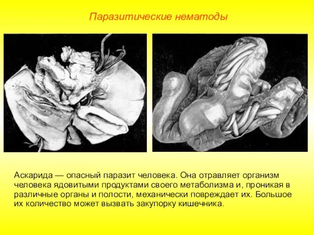 Аскарида — опасный паразит человека. Она отравляет организм человека ядовитыми продуктами своего