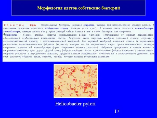 Морфология клеток собственно бактерий Helicobacter pylori