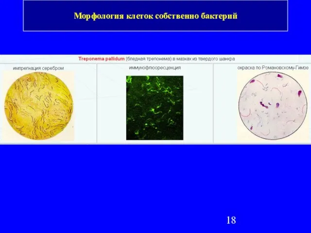 Морфология клеток собственно бактерий