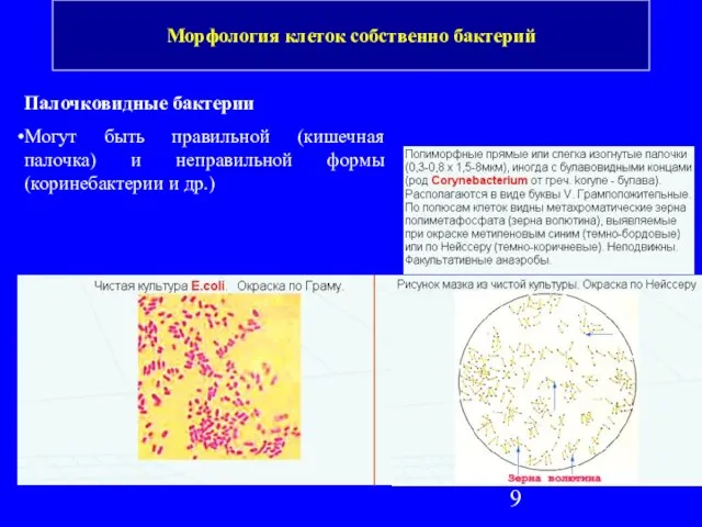 Палочковидные бактерии Могут быть правильной (кишечная палочка) и неправильной формы (коринебактерии и