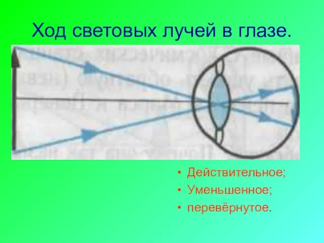 Ход световых лучей в глазе. Действительное; Уменьшенное; перевёрнутое.