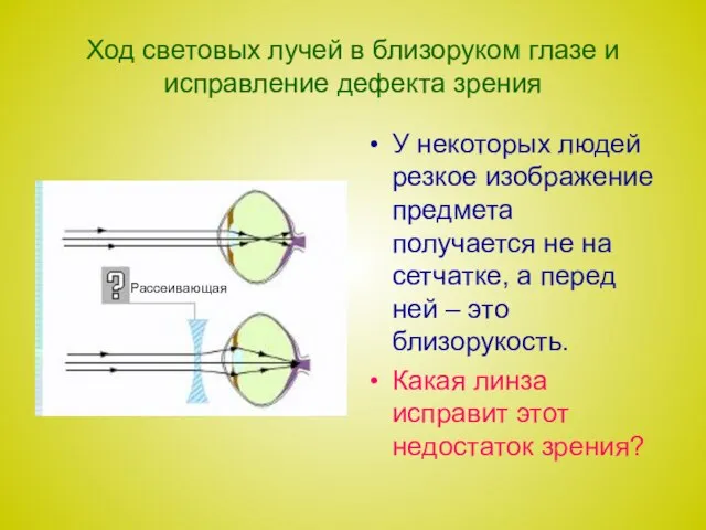 Ход световых лучей в близоруком глазе и исправление дефекта зрения У некоторых