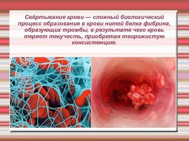 Свёртывание крови — сложный биологический процесс образования в крови нитей белка фибрина,