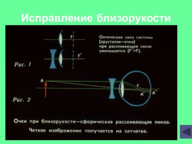 Исправление близорукости