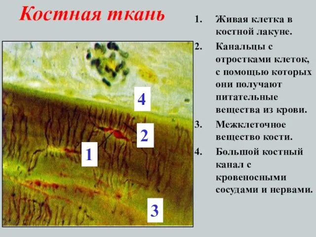 Костная ткань Живая клетка в костной лакуне. Канальцы с отростками клеток, с