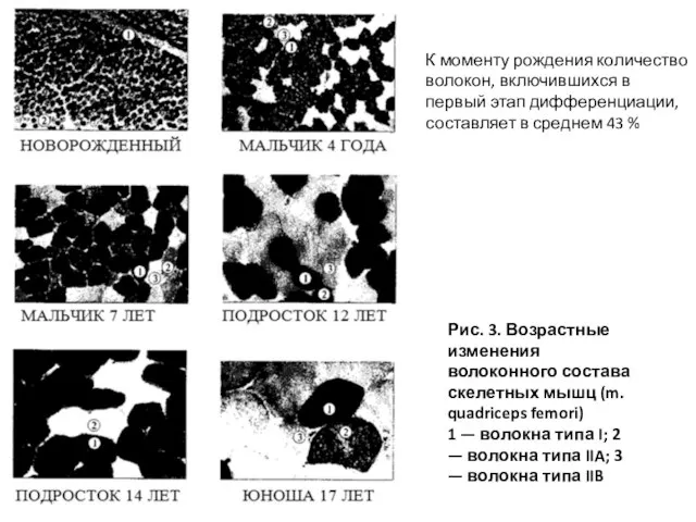 Рис. 3. Возрастные изменения волоконного состава скелетных мышц (m. quadriceps femori) 1