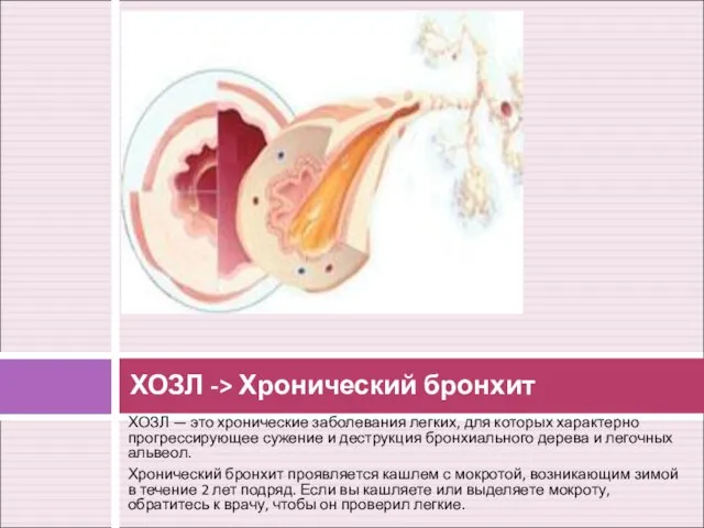 ХОЗЛ — это хронические заболевания легких, для которых характерно прогрессирующее сужение и